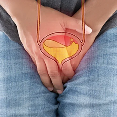 prostata.webp prostata.webp